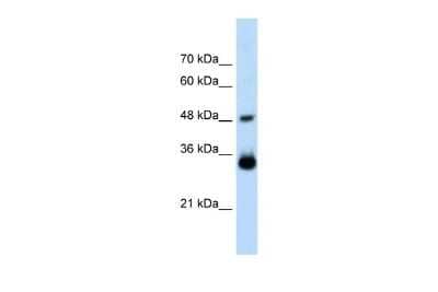 Western Blot: HOXC9 Antibody [NBP2-87596]