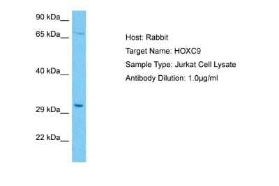 Western Blot: HOXC9 Antibody [NBP2-87596]
