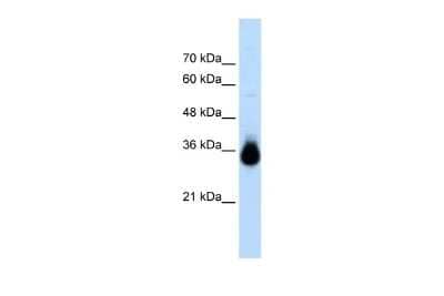 Western Blot: HOXC9 Antibody [NBP2-87597]