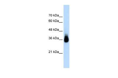 Western Blot: HOXC9 Antibody [NBP2-87598]