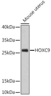 Western Blot: HOXC9 AntibodyAzide and BSA Free [NBP3-04479]