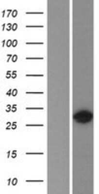 Western Blot: HOXC9 Overexpression Lysate [NBP2-07565]