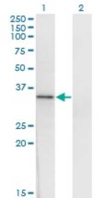 Western Blot: HOXD1 Antibody (4F4) [H00003231-M01]