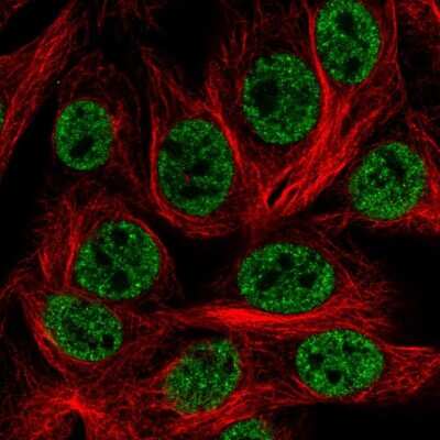 Immunocytochemistry/ Immunofluorescence: HOXD1 Antibody [NBP2-55201]