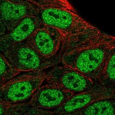 Immunocytochemistry/ Immunofluorescence: HOXD1 Antibody [NBP2-58710]