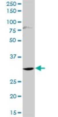 Western Blot: HOXD1 Antibody [H00003231-D01P]