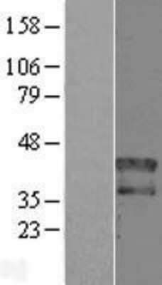 Western Blot: HOXD1 Overexpression Lysate [NBL1-11681]