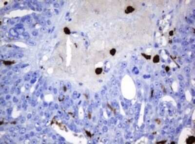 Immunohistochemistry: HOXD10 Antibody (OTI1D11) [NBP2-45744]