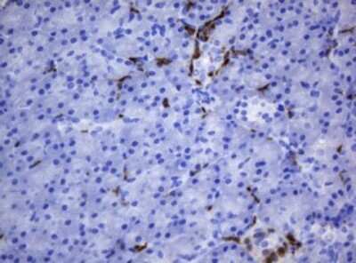 Immunohistochemistry: HOXD10 Antibody (OTI1D11) [NBP2-45744]