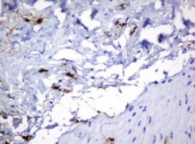 Immunohistochemistry: HOXD10 Antibody (OTI1D11) [NBP2-45744]