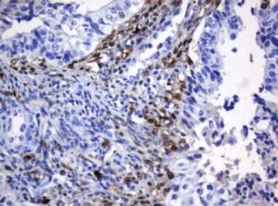Immunohistochemistry: HOXD10 Antibody (OTI1D11) [NBP2-45744]
