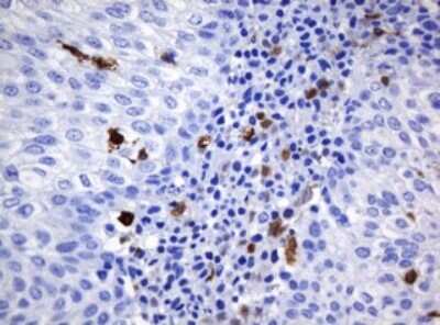 Immunohistochemistry: HOXD10 Antibody (OTI1D11) [NBP2-45744]