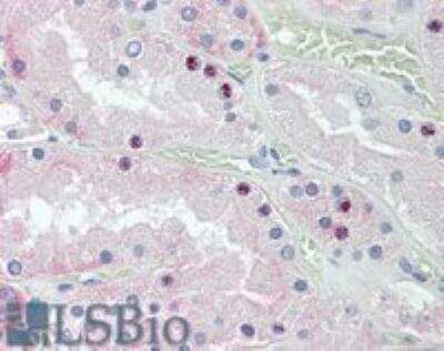 Immunohistochemistry: HOXD10 Antibody [NBP1-28476]