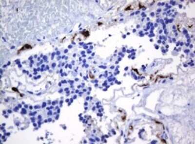 Immunohistochemistry: HOXD10 Antibody (OTI1D11) - Azide and BSA Free [NBP2-70920]