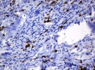 Immunohistochemistry: HOXD10 Antibody (OTI1D11) - Azide and BSA Free [NBP2-70920]