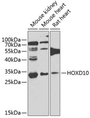 Western Blot: HOXD10 AntibodyBSA Free [NBP3-04565]