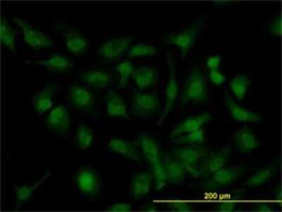 Immunocytochemistry/ Immunofluorescence: HOXD11 Antibody (5E7) [H00003237-M01]