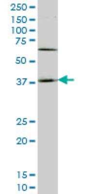 Western Blot: HOXD11 Antibody (5E7) [H00003237-M01]