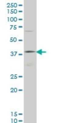 Western Blot: HOXD11 Antibody (5G4) [H00003237-M03]