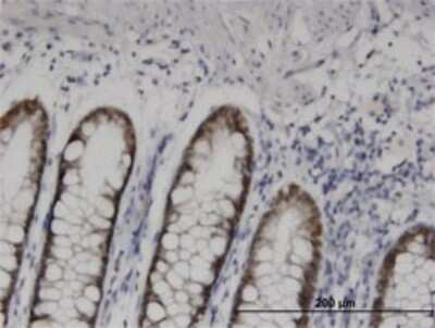 Immunohistochemistry-Paraffin: HOXD11 Antibody (6C8) [H00003237-M10]
