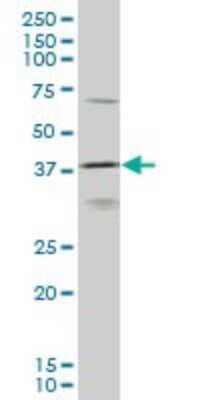 Western Blot: HOXD11 Antibody (6C8) [H00003237-M10]