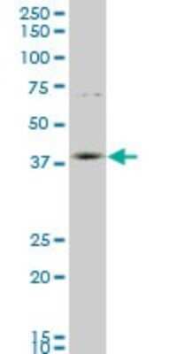 Western Blot: HOXD11 Antibody (6D8) [H00003237-M06]