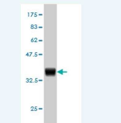 Western Blot: HOXD11 Antibody (8C7) [H00003237-M02]