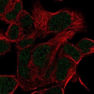 Immunocytochemistry/ Immunofluorescence: HOXD11 Antibody [NBP2-58044]