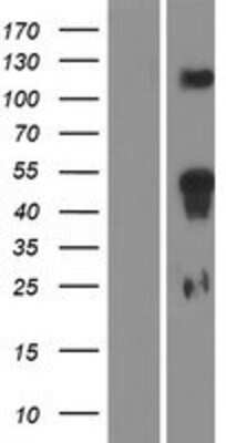 Western Blot: HOXD11 Overexpression Lysate [NBP2-06547]