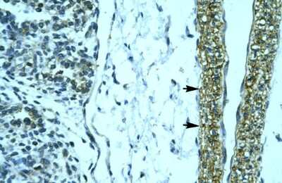Immunohistochemistry: HOXD12 Antibody [NBP2-85074]