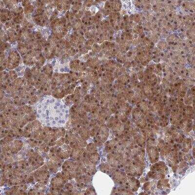 Immunohistochemistry-Paraffin: HOXD12 Antibody [NBP2-32462]