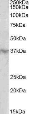 Western Blot: HOXD12 Antibody [NBP2-26178]