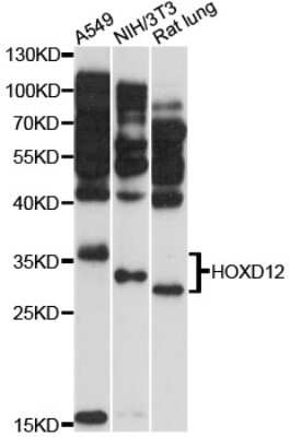 Western Blot: HOXD12 AntibodyAzide and BSA Free [NBP3-04489]