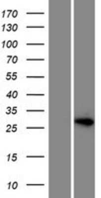 Western Blot: HOXD12 Overexpression Lysate [NBP2-06548]