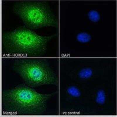 Immunocytochemistry/ Immunofluorescence: HOXD13 Antibody [NBP1-52149]