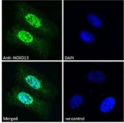 Immunocytochemistry/ Immunofluorescence: HOXD13 Antibody [NBP1-52149]