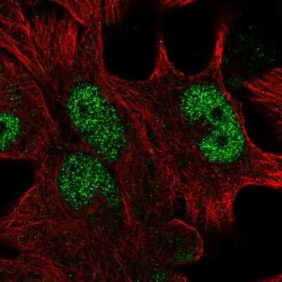 Immunocytochemistry/ Immunofluorescence: HOXD13 Antibody [NBP2-55987]