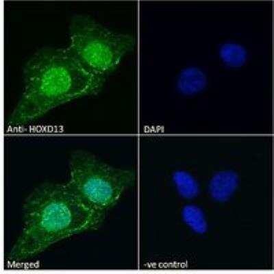 Immunocytochemistry/ Immunofluorescence: HOXD13 Antibody [NBP2-75091]