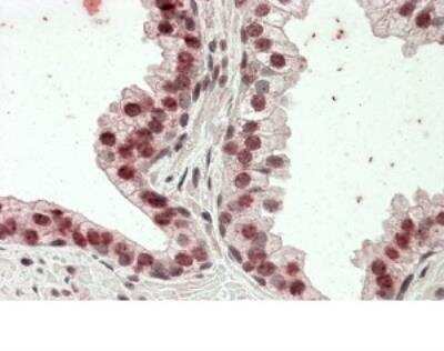 Immunohistochemistry-Paraffin: HOXD13 Antibody [NBP1-52149]