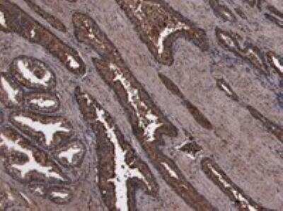 Immunohistochemistry-Paraffin: HOXD13 Antibody [NBP2-75091]