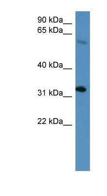 Western Blot: HOXD13 Antibody [NBP1-79989]