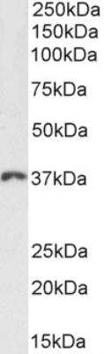 Western Blot: HOXD13 Antibody [NBP2-75091]