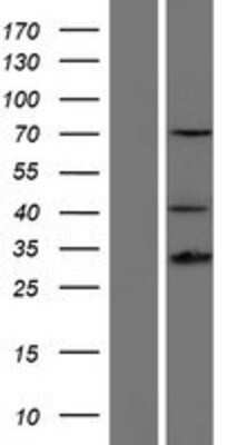 Western Blot: HOXD13 Overexpression Lysate [NBP2-09013]