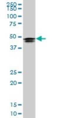 Western Blot: HOXD3 Antibody (1B12) [H00003232-M09]