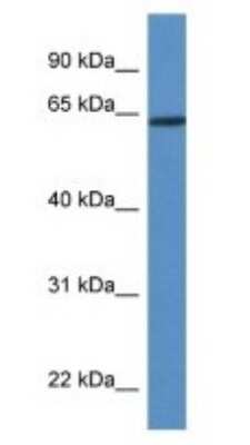 Western Blot: HOXD3 Antibody [NBP1-74094]