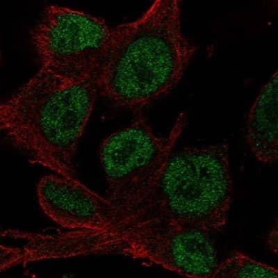 Immunocytochemistry/ Immunofluorescence: HOXD4 Antibody [NBP2-49631]