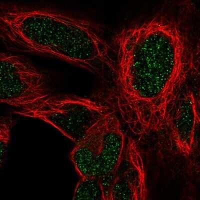 Immunocytochemistry/ Immunofluorescence: HOXD4 Antibody [NBP2-58125]