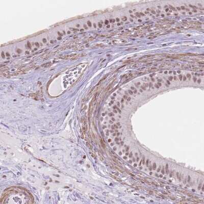 Immunohistochemistry-Paraffin: HOXD4 Antibody [NBP2-49631]