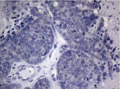 Immunohistochemistry: HOXD4 Antibody (OTI1E9) - Azide and BSA Free [NBP2-70919]