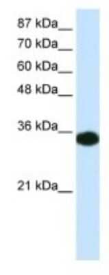 Western Blot: HOXD4 Antibody [NBP3-11018]